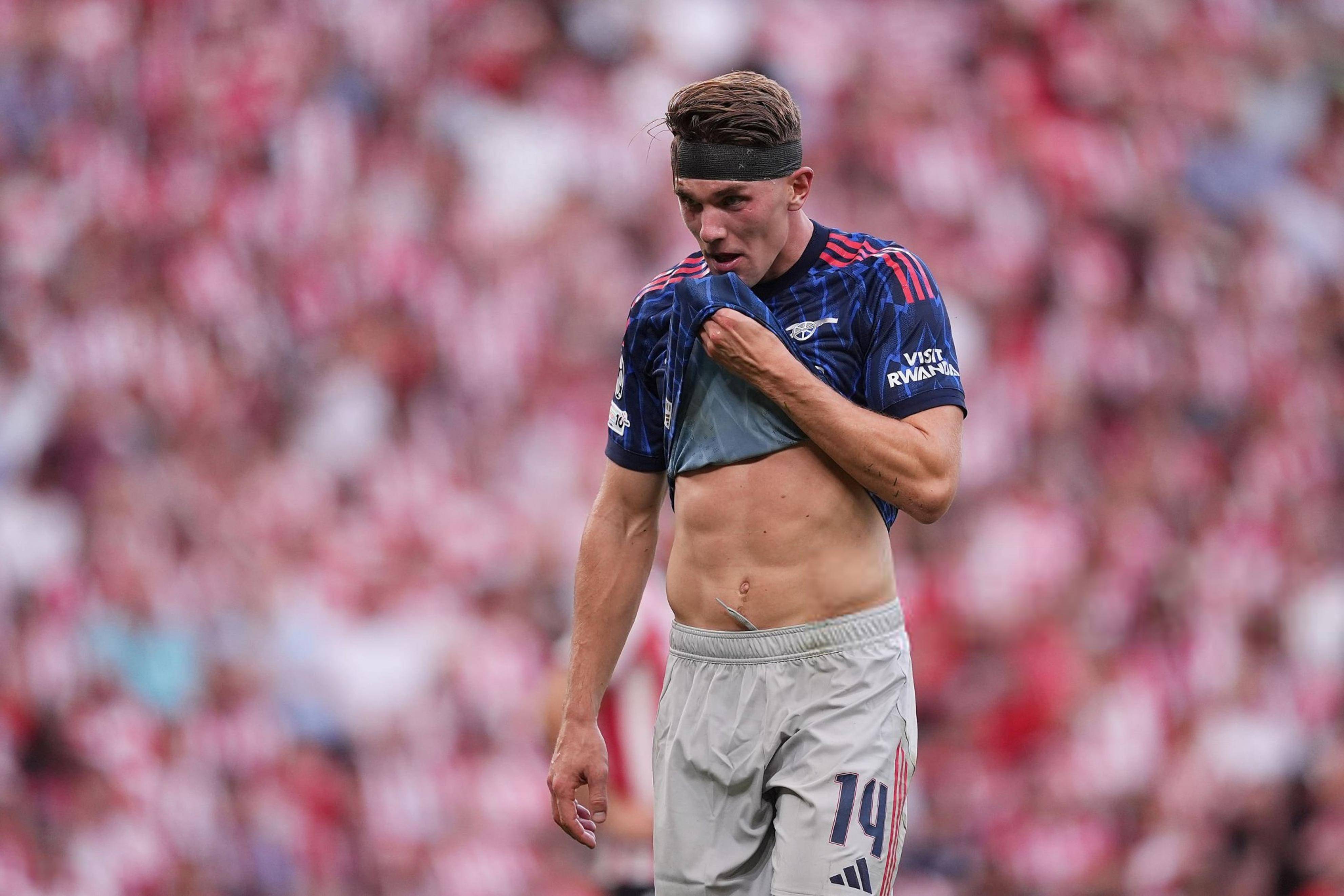 包含马杜埃凯原有望在与桑德兰比赛回归阿森纳选择让球员获得更多恢复时间的词条